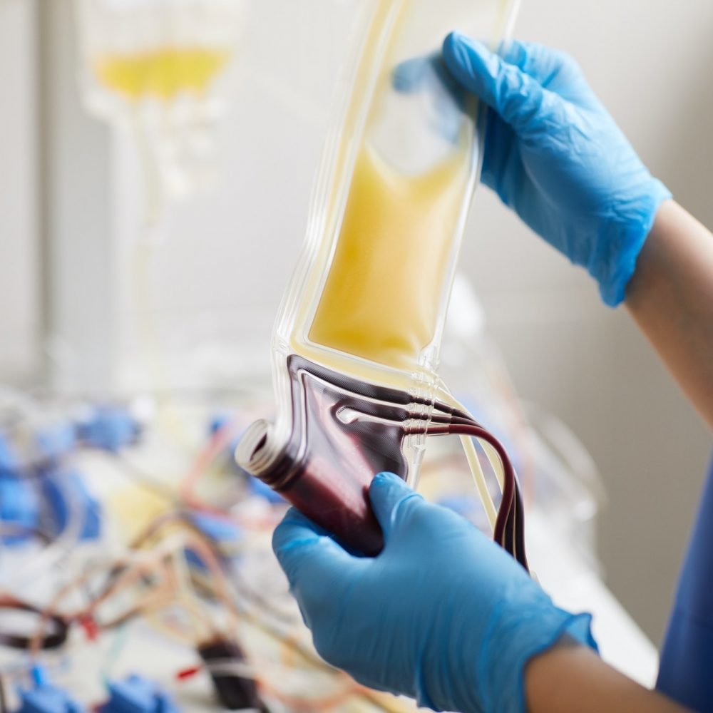 Dropper with medicine and blood samples